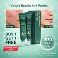✨ Get Clear Skin Fast – Acne Spot Corrector Gel